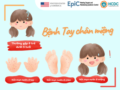 Chủ động phòng bệnh tay chân miệng từ nhà trường đến cộng đồng