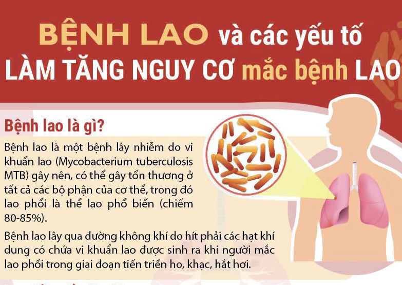 Bệnh lao và các yếu tố làm tăng nguy cơ mắc bệnh lao