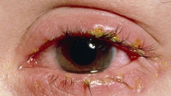 Điểm tin nhanh ngày 06/09/2023