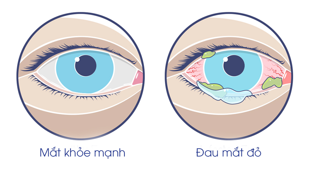 Điểm tin nhanh ngày 08/09/2023