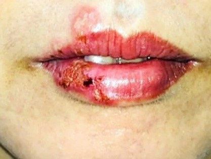 Điểm tin nhanh ngày 26/8/2024