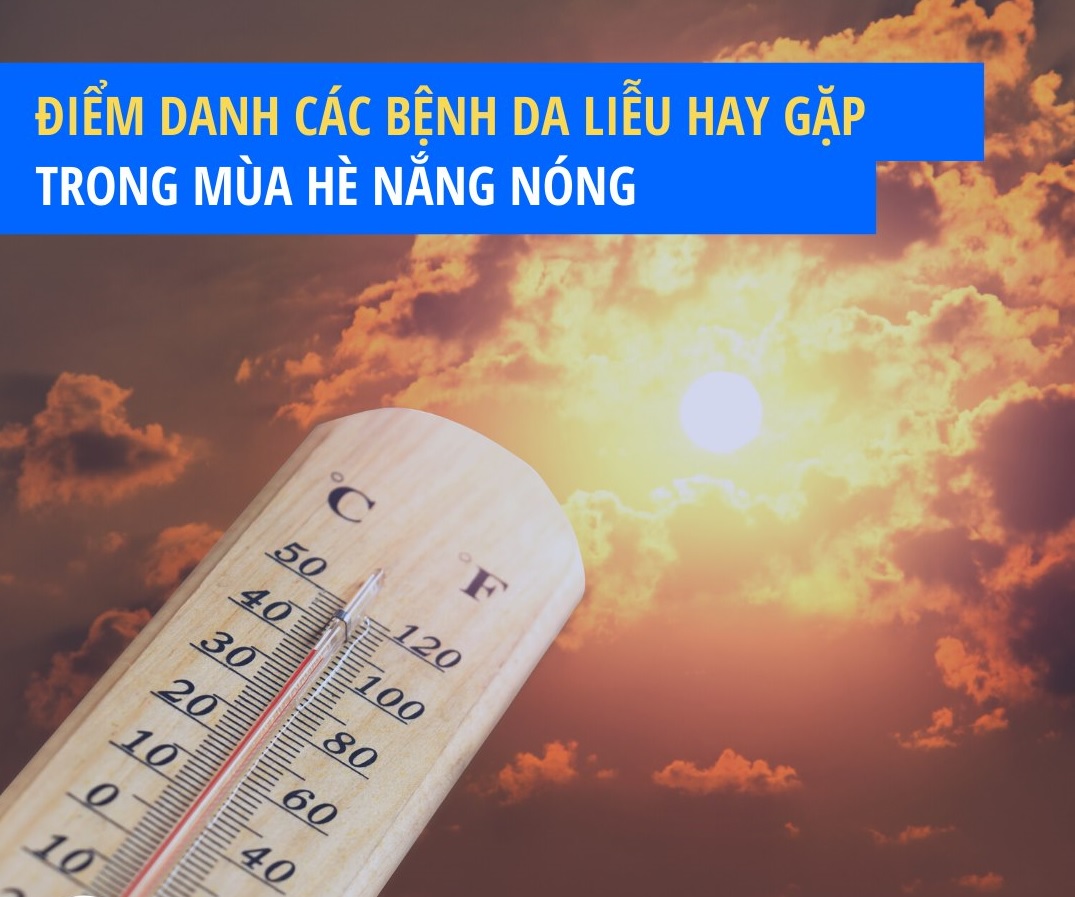 Điểm báo ngày 05/7/2021