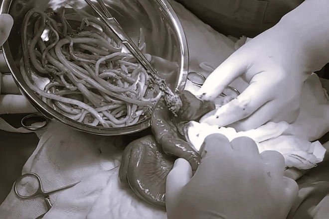 Điểm tin nhanh ngày 06/11/2024